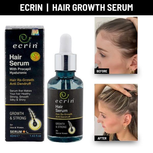 Ecrin Hair Growth Serum 40ml – Boost Hair Regrowth | Anti-Hair Fall | Dandruff Control | Essential Oil Infused